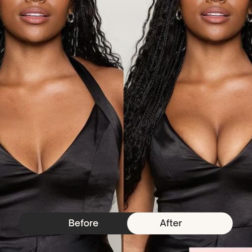 Instant Lift Sticky Bra Pads