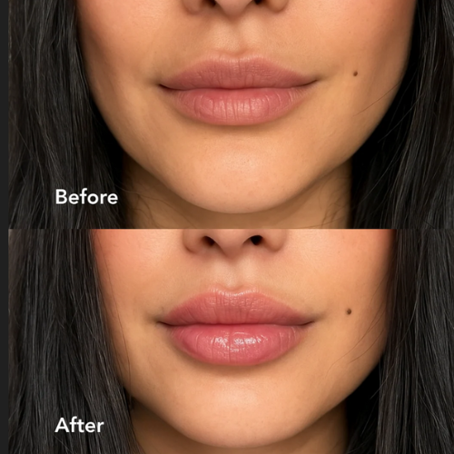 Extreme Lip Plumper