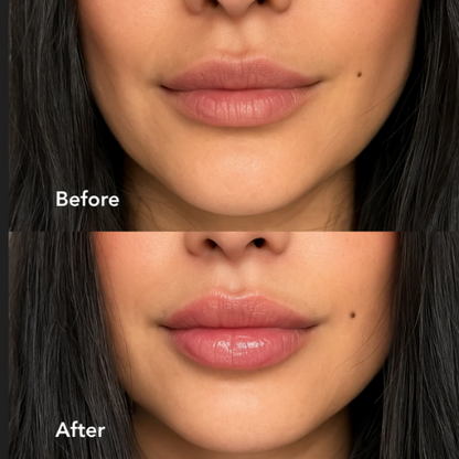 Extreme Lip Plumper